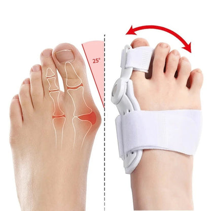 1 Pair of High - Quality Bunion Toe Corrector and Straightener - Tru Tulip