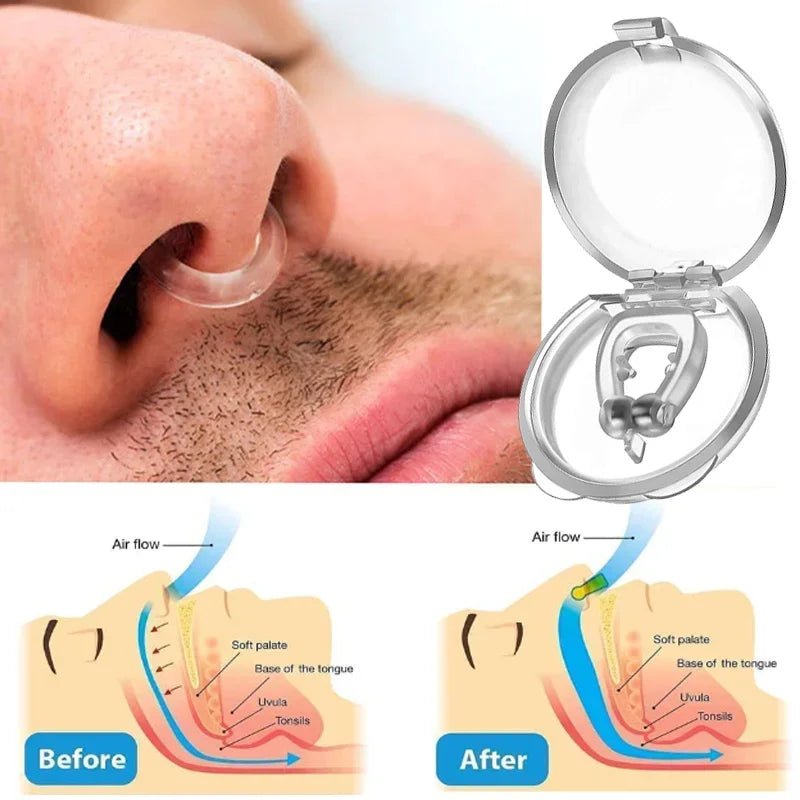 Snore Stopper – 4pcs Anti - Snore Silicone Magnetic Nose Clip - Tru Tulip