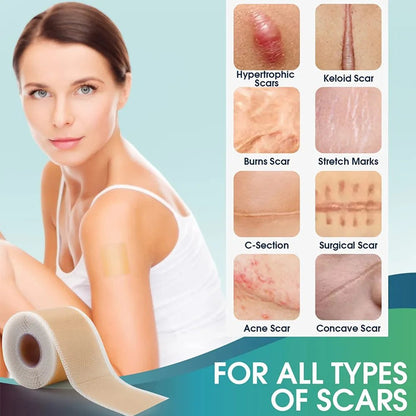 Soft Soothing Silicone Scar Tape for Getting Rid of All Kinds of Scars - Tru Tulip