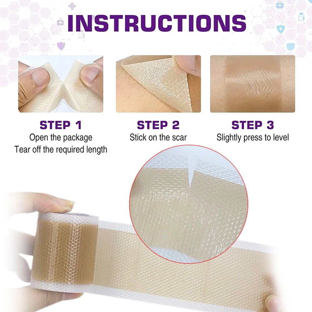 Soft Soothing Silicone Scar Tape for Getting Rid of All Kinds of Scars - Tru Tulip