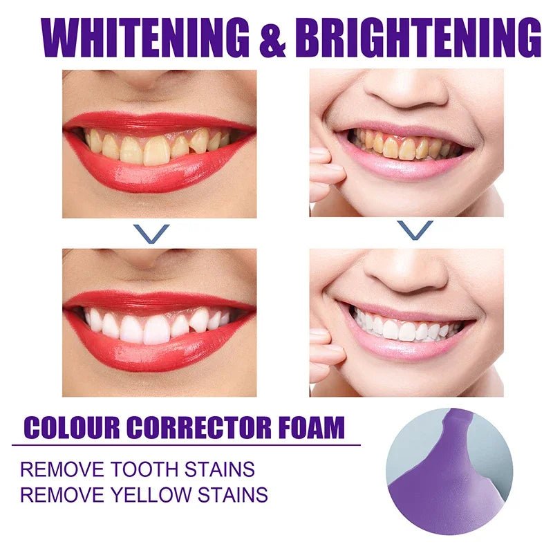 Yellow and All Stain Cleaning Toothpaste with Teeth Whitening and Oral Fresh Tooth Care. - Tru Tulip