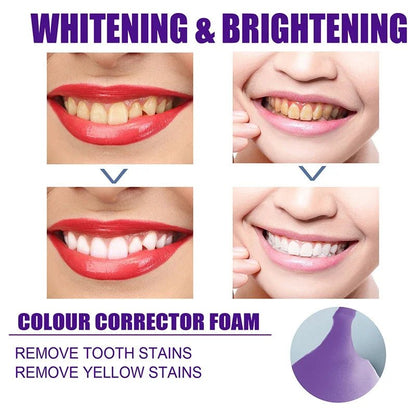 Yellow and All Stain Cleaning Toothpaste with Teeth Whitening and Oral Fresh Tooth Care. - Tru Tulip